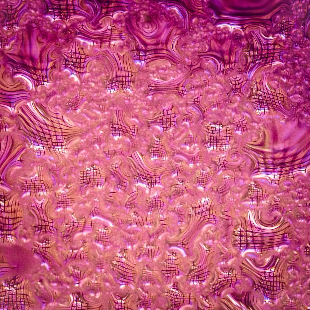 LSD